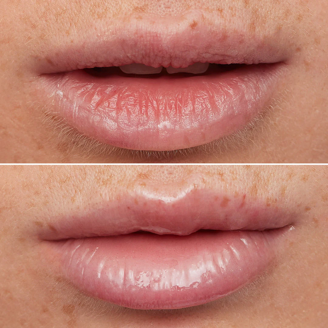 Lip Rehab Serum Oil - Image 4