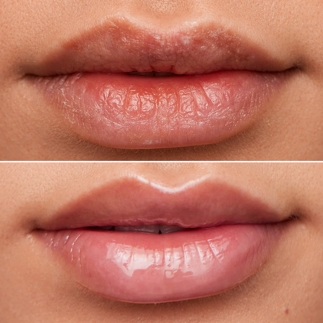 Lip Rehab Serum Oil - Image 3